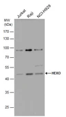 Anti-ERI1 antibody used in Western Blot (WB). GTX117034