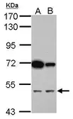 Anti-CUGBP2 antibody used in Western Blot (WB). GTX117035