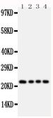 Anti-FGF22 antibody used in Western Blot (WB). GTX11704