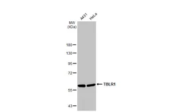 Anti-TBLR1 antibody [N1N3] used in Western Blot (WB). GTX117048