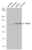 Anti-INPP5F antibody used in Western Blot (WB). GTX117067