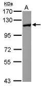 Anti-HIP1R antibody [N1N2], N-term used in Western Blot (WB). GTX117072