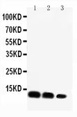 Anti-CXCL16 antibody used in Western Blot (WB). GTX11708