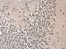 Anti-PRPF31 antibody used in IHC (Paraffin sections) (IHC-P). GTX117081