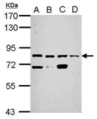 Anti-KLHL1 antibody used in Western Blot (WB). GTX117085