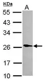 Anti-Phospholipase A2 XIIA antibody [N1C3] used in Western Blot (WB). GTX117089