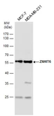 Anti-ZNHIT6 antibody used in Western Blot (WB). GTX117090