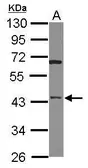 Anti-HTRA3 antibody [N3C3] used in Western Blot (WB). GTX117101