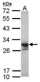 Anti-LIN7A antibody [N1C3] used in Western Blot (WB). GTX117114