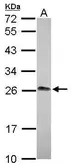 Anti-LIN7A antibody [N1C3] used in Western Blot (WB). GTX117114
