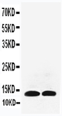 Anti-IL13 antibody used in Western Blot (WB). GTX11712