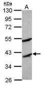 Anti-MOGAT2 antibody used in Western Blot (WB). GTX117145