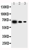 Anti-IL23 antibody used in Western Blot (WB). GTX11715