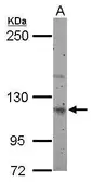 Anti-Munc 13-4 antibody [N1N2], N-term used in Western Blot (WB). GTX117155