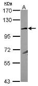 Anti-KA1 antibody [N1N2], N-term used in Western Blot (WB). GTX117163