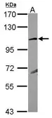 Anti-KA1 antibody [N1N2], N-term used in Western Blot (WB). GTX117163