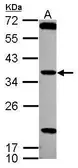 Anti-TSSK4 antibody [N2C3] used in Western Blot (WB). GTX117165