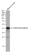 Anti-gamma Sarcoglycan antibody used in Western Blot (WB). GTX117176