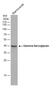 Anti-gamma Sarcoglycan antibody used in Western Blot (WB). GTX117176