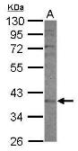 Anti-CYP2F1 antibody [N1C1] used in Western Blot (WB). GTX117184