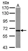 Anti-RAB11FIP1 antibody [N1N2], N-term used in Western Blot (WB). GTX117197