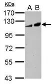 Anti-Adenylate cyclase 2 antibody [N1N3] used in Western Blot (WB). GTX117223