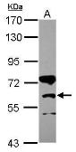Anti-CPT1B antibody [C1C2], Internal used in Western Blot (WB). GTX117231