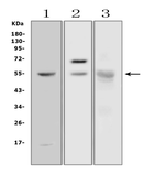 Anti-Amylase antibody used in Western Blot (WB). GTX11728