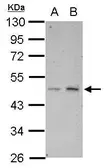 Anti-HTRA3 antibody used in Western Blot (WB). GTX117280