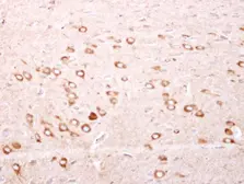 Anti-Mitochondrial Ferritin antibody [N1C3] used in IHC (Paraffin sections) (IHC-P). GTX117281