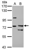 Anti-FOXP4 antibody [N1N3] used in Western Blot (WB). GTX117293