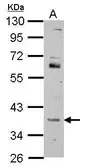 Anti-FOXR2 antibody used in Western Blot (WB). GTX117300