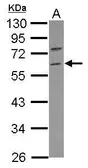 Anti-RNF36 antibody [N2C2], Internal used in Western Blot (WB). GTX117303