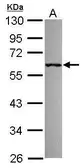 Anti-RNF36 antibody [C1C3] used in Western Blot (WB). GTX117304