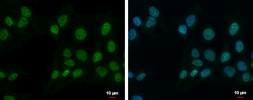 Anti-ZNF596 antibody [N1N3] used in Immunocytochemistry/ Immunofluorescence (ICC/IF). GTX117309