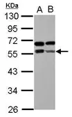 Anti-ZBTB9 antibody used in Western Blot (WB). GTX117314