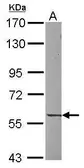 Anti-UNC5CL antibody [C1C3] used in Western Blot (WB). GTX117321