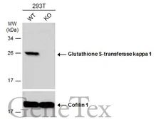 Anti-Glutathione S-transferase kappa 1 antibody used in Western Blot (WB). GTX117326
