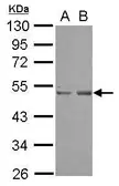 Anti-SETD7 antibody [N1C1] used in Western Blot (WB). GTX117333
