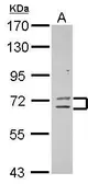 Anti-ZNF182 antibody used in Western Blot (WB). GTX117343