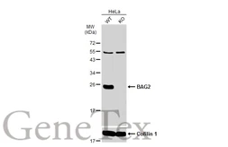 Anti-BAG2 antibody [N1C3-2] used in Western Blot (WB). GTX117345