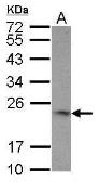 Anti-4-1BBL / CD137L antibody [N2C3] used in Western Blot (WB). GTX117355