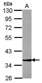 Anti-ZNF396 antibody used in Western Blot (WB). GTX117367