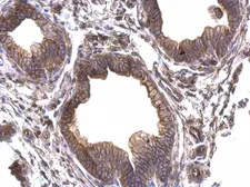 Anti-Periplakin antibody [N1N2], N-term used in IHC (Paraffin sections) (IHC-P). GTX117411