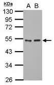 Anti-GTF2A1 antibody used in Western Blot (WB). GTX117420
