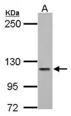 Anti-PMCA3 ATPase antibody [N3C2], Internal used in Western Blot (WB). GTX117433