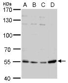Anti-Visfatin antibody [N1N3] used in Western Blot (WB). GTX117444