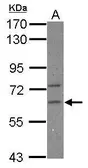 Anti-CPEB2 antibody used in Western Blot (WB). GTX117457