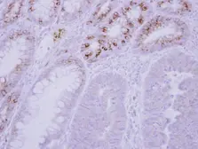 Anti-GCKR antibody used in IHC (Paraffin sections) (IHC-P). GTX117492