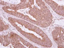 Anti-TXNDC6 antibody used in IHC (Paraffin sections) (IHC-P). GTX117495